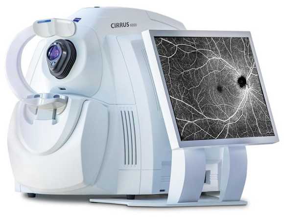  Diagnóstico do glaucoma 